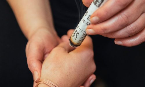 Utilisation du moxa lors d'une séance de médecine chinoise antique – Le Singulier Universel, Lyon